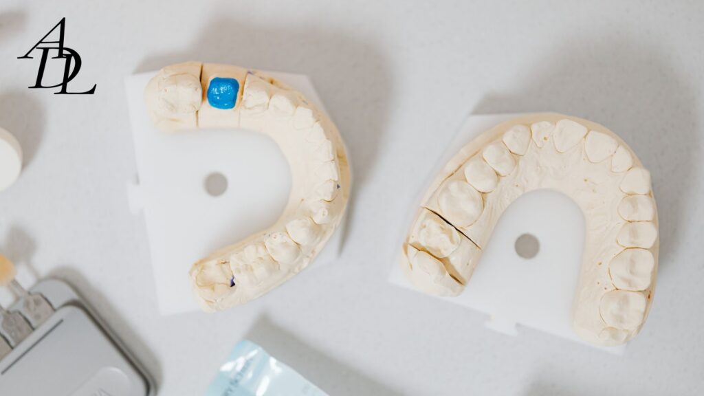 Two Dental Cast Models with one die on the molar of lower left model.